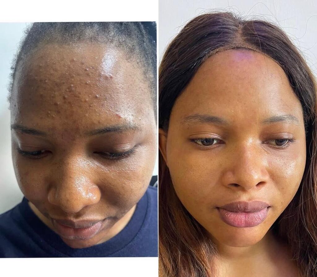 BluOrchid clinic patient result