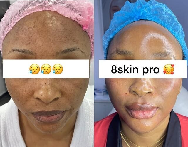 BluOrchid clinic patient result
